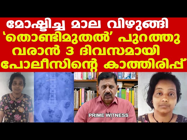 ഫഹദിന്റെ സിനിമ പോലെ ആയി..| വയറിളക്കിയിട്ടും 3 ദിവസമായിട്ടും മാല പുറത്തുവന്നില്ല | George Joseph Retd