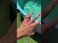 WHEN JAWS ATTACKS YOU WHEN JAWS ATTACKS YOU