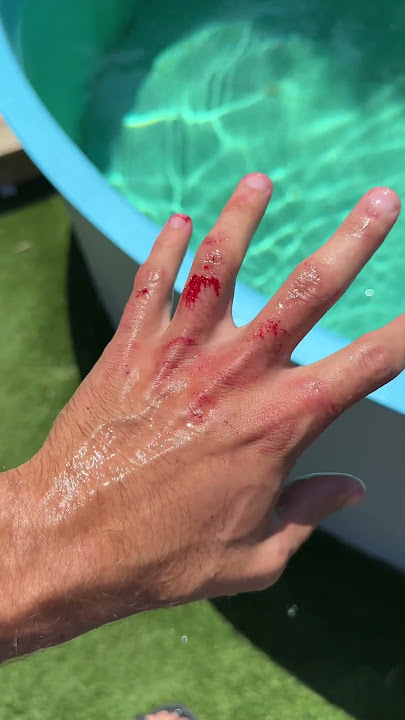 Download lagu WHEN JAWS ATTACKS YOU!