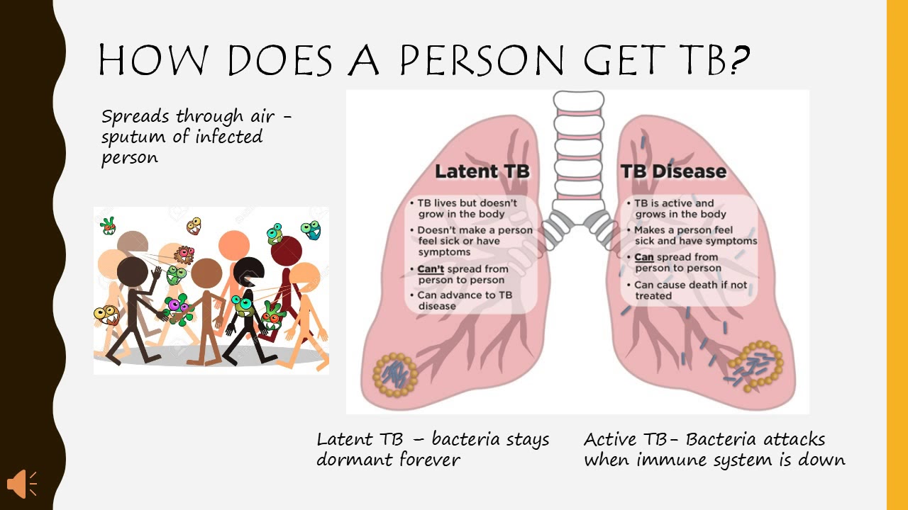 The Deadly Disease Tuberculosis