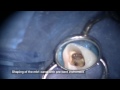 VDW Dental · Dr. Christoph Kaaden: RECIPROC blue root canal preparation (clinical video)