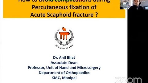 How to Avoid Complications during Percutaneous Fixation of Acute Scaphoid Fracture ? - Dr Anil Bhat