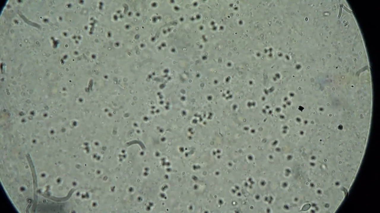 Life Under Microscope x200 Infusoria in Water Drop YouTube