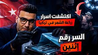 السر التاني اللي كان سبب في نجاح أكبر مستشفى زراعة شعر في العالم هو التقنية المستخدمة في الزراعة