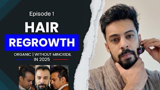 Episode 1 Reverse Male Pattern Baldness My Hair Growth Journey Devendra Singh