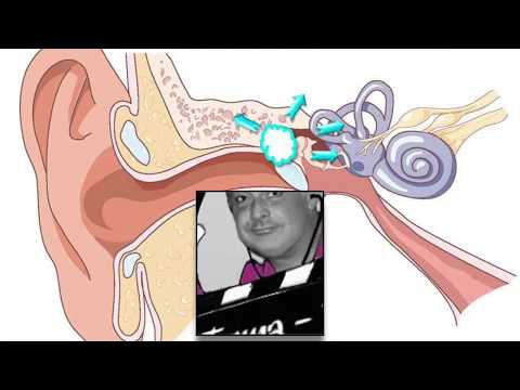 Video: Quistes De Oído (colesteatoma) En Perros