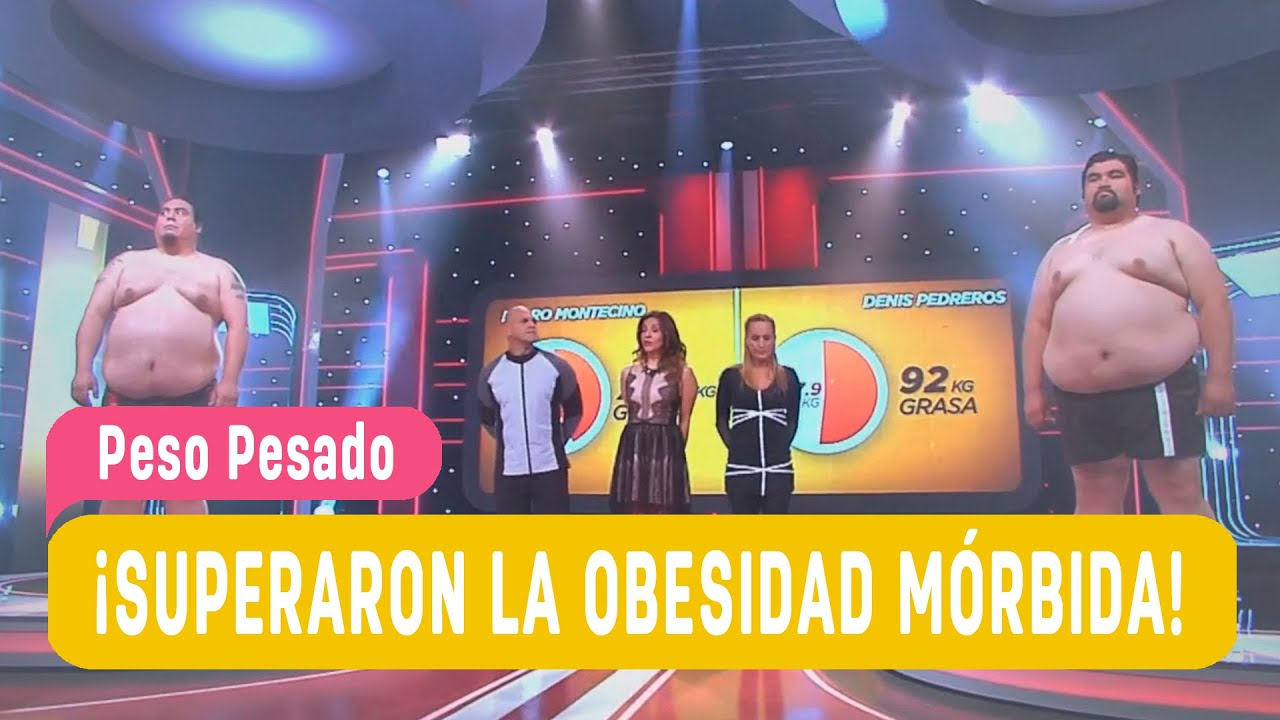 La obesidad morbida spanish edition