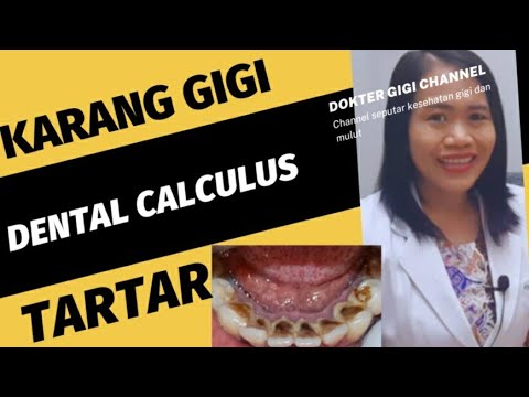 Video: Plak Pada Gigi: Cacat Kosmetik Atau Ancaman Bagi Kesehatan?