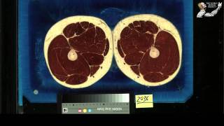 The visible human project - Male (HD)