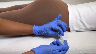 How to locate the ventrogluteal (VG) injection site