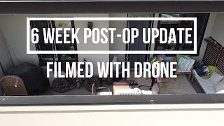 Tibial Plateau Fracture - 6 Week Post-Op Knee Update
