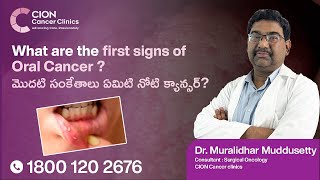 Play video: What are the first signs of Oral Cancer