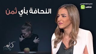 من 61 كيلو الى 43 كيلو في سنة واحدة..تعرفوا على تجربة لين مع فقدان الشهية العصبي