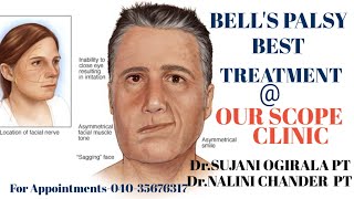 Bell's Palsy Advance Treatment Available@OUR SCOPE CLINIC Dr.Sujani Ogirala PT& Dr.Nalini chander PT