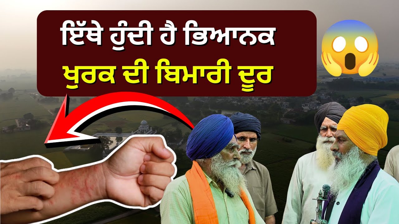 ਇੱਥੇ ਹੁੰਦੀ ਹੈ ਭਿਆਨਕ ਖੁਰਕ ਦੀ ਬਿਮਾਰੀ ਦੂਰ 😱 Ep-9 | Safar-E-Shahadat |