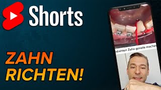 Verdrehten Zahn Richten