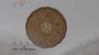 Pond Life Through the Microscope: Slide Survey 12