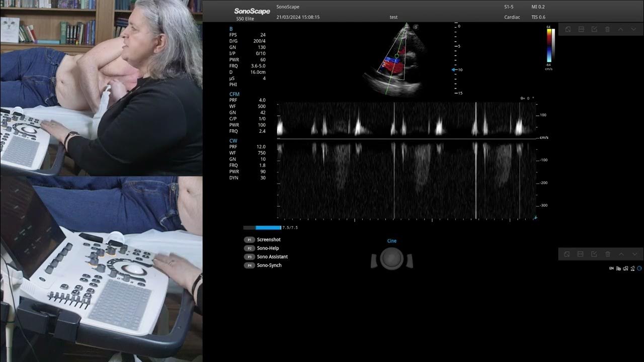 Мастер-класс по эхокардиографии. Лектор: Рыбакова М.К. - YouTube