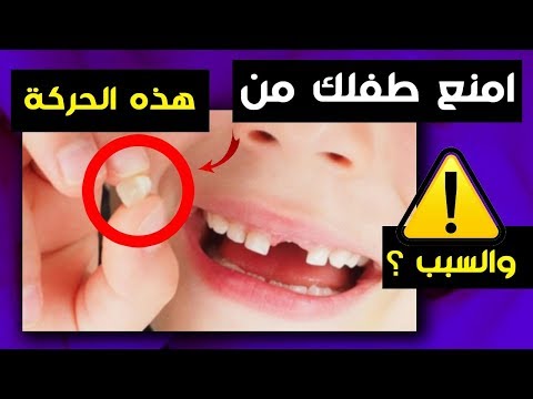 امنع طفلك من هذه الحركة !!