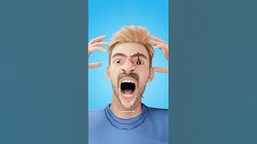 What To Do If You