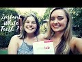 INSTANT WHITE TEETH ?! Smilelab Review