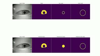 Iris segmentation Novel algorithm
