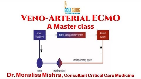 Veno-arterial ECMO (V-A ECMO) - Indications, ventilator management, Life-saving cardiac support