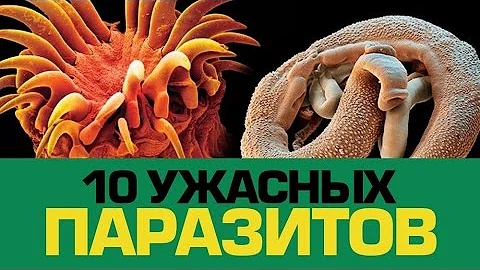 10 Ужасных ПАРАЗИТОВ, которые могут жить в тебе