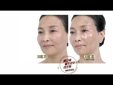 메디엘 울트라V리프팅 세럼 Mediel Ultra V Lifting Serum