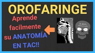 Anatomía (OROFARINGE) en TOMOGRAFÍA