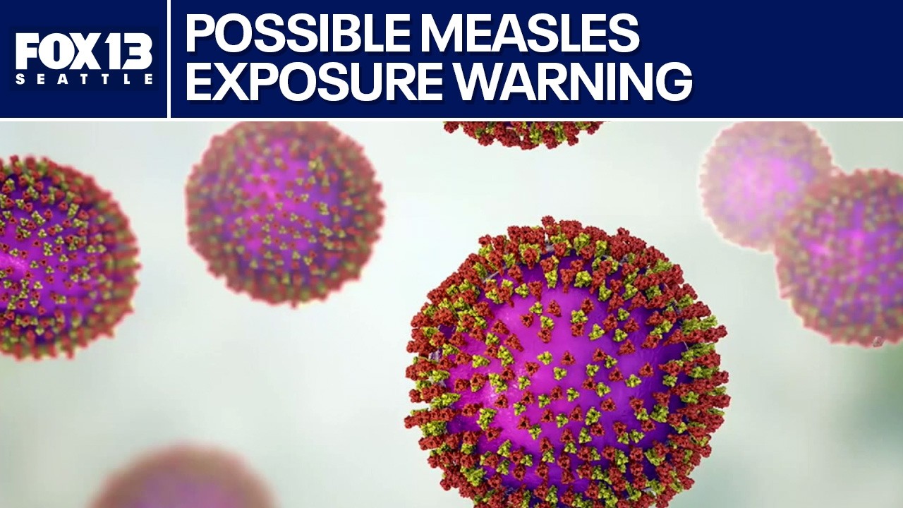 Possible measles exposure reported in Bellevue, Seattle and light rail ...