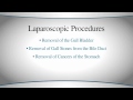 What is laparoscopic surgery