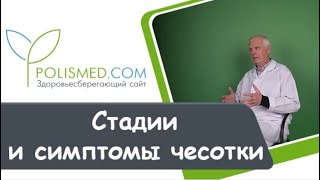 Стадии и симптомы чесотки: высыпания, зуд, температура. Запущенная чесотка