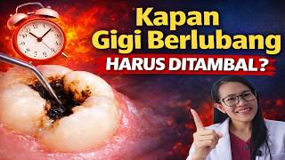 Kapan gigi berlubang harus ditambal?