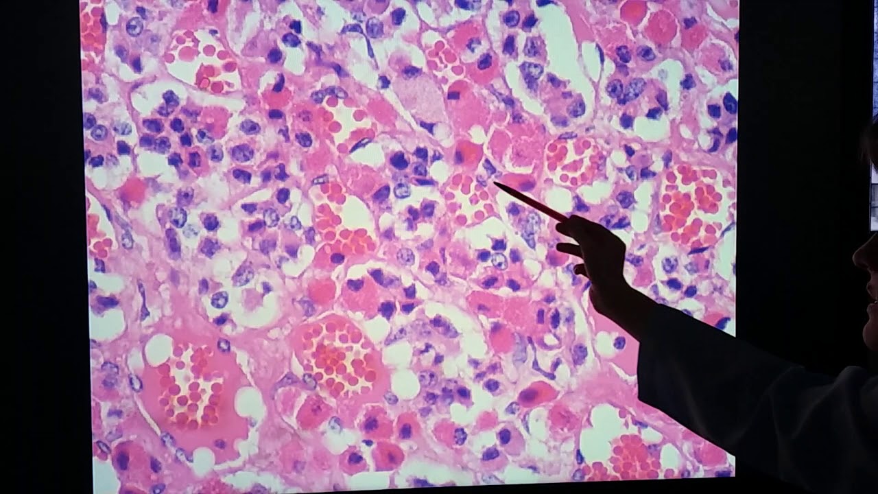 Histologia da Hipófise