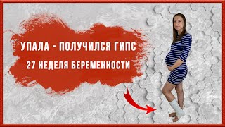 27 неделя беременности. Подскользнулась, упала - получился гипс.