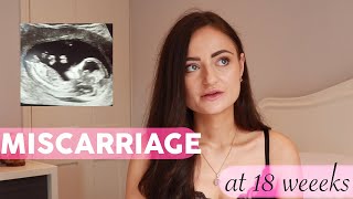 My Miscarriage at 18 Weeks | Low Amniotic Fluid, Low PappA & Small Baby