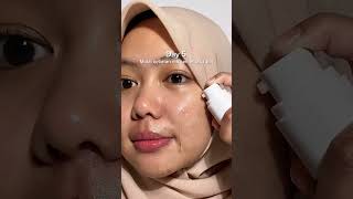Acne serum yang worth to try💅🏻 #pov #viral #fyp #skincare #beauty #makeup #facerinna #shortsvideo