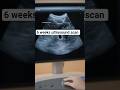 6 Weeks Ultrasound Scan | How It is Growing Up!#shorts