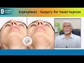 SEPTOPLASTY - Deviated Septum Surgery for breathing difficulty - Dr.Harihara Murthy |Doctors&#39; Circle