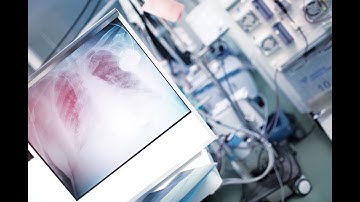 Mechanical Ventilation in ARDS