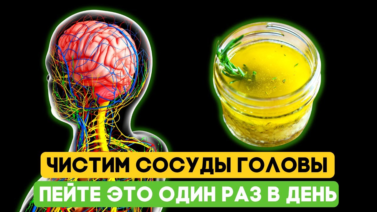 ТРОМБЫ уйдут! Чистим СОСУДЫ головы! Пейте этот раствор каждый день, и ...