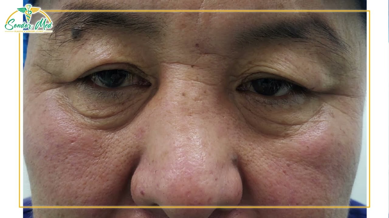 👁 ЗОВХИ ТАТАХ МЭС ЗАСАЛ 👁