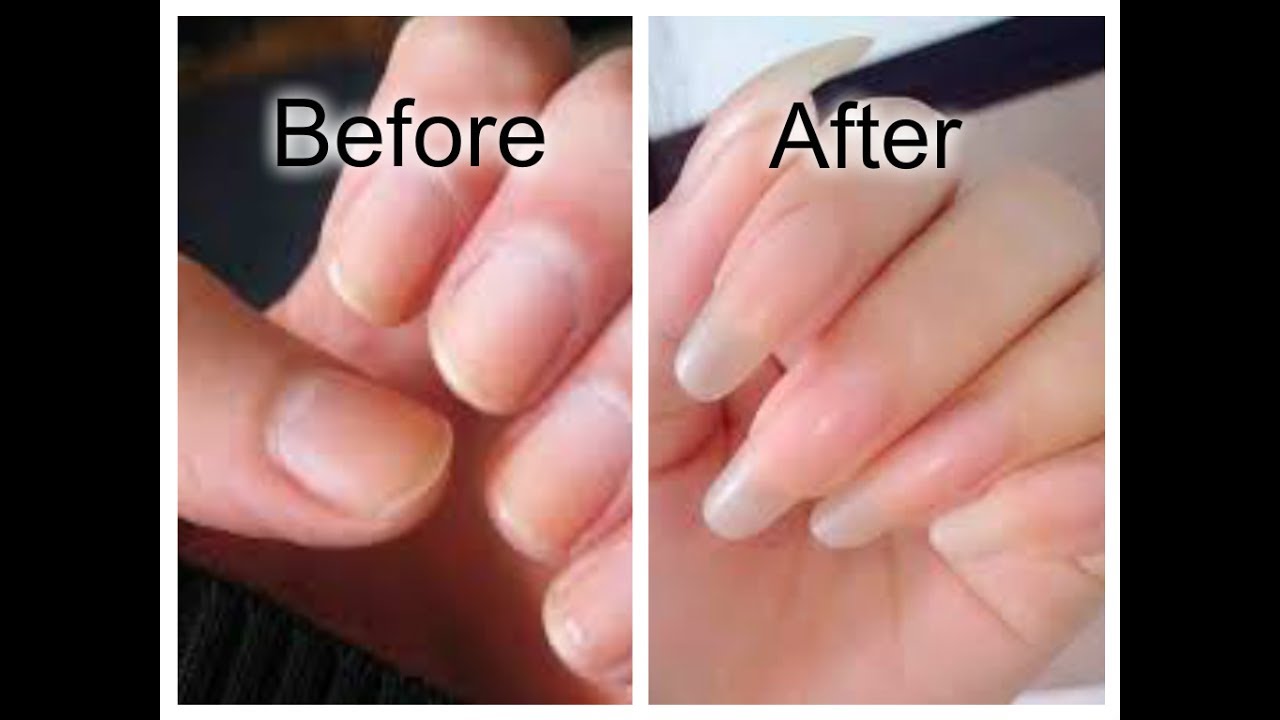 HOW TO GROW YOUR NAILS FASTER! - YouTube