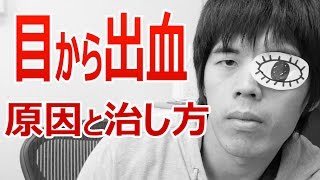 目から出血…原因と治し方！