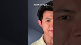 It’s kinda cute tho! ☺️💚 #funny #cute  #dimple #fyp #shorts #trend