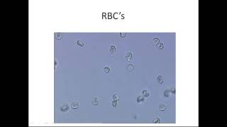 Microscopic Urinalysis