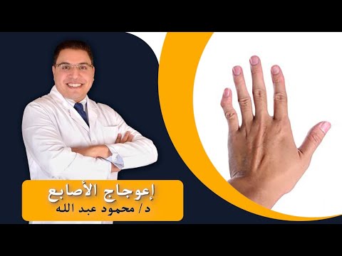   التهاب واعوجاج اصابع اليد