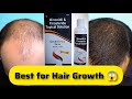 Best Minoxidil For Hair Regrowth | Coverit Plus Spray | Best Minoxidil Finasteride Topical Solution