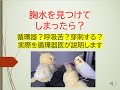 胸水を見つけてしまったら(実際の診療の流れを循環器医が解説します)